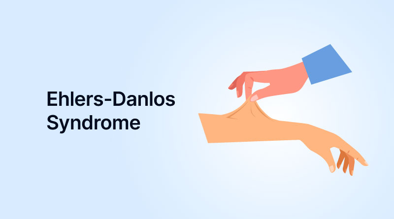 Are Your Mystery Symptoms Related to Ehlers-Danlos Syndrome?