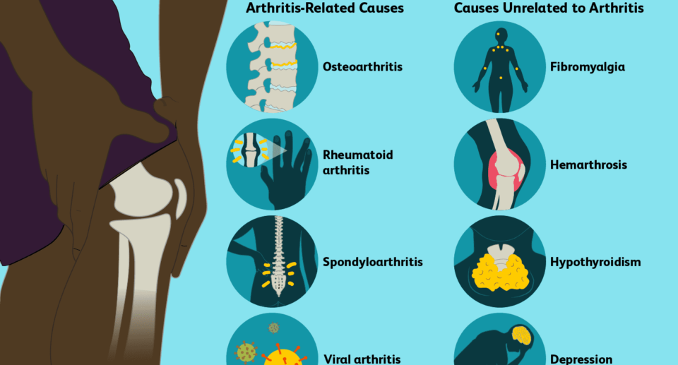 Do You Struggle with Stiff Joints? 13 Ways to Find Relief