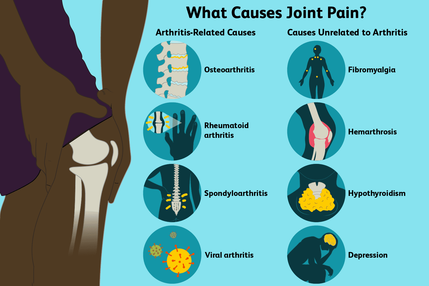 Do You Struggle with Stiff Joints? 13 Ways to Find Relief