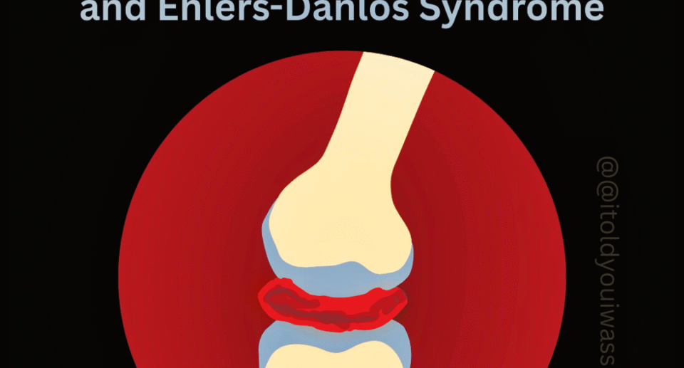 The Interesting Link Between Neurodivergence and Ehlers-Danlos Syndrome